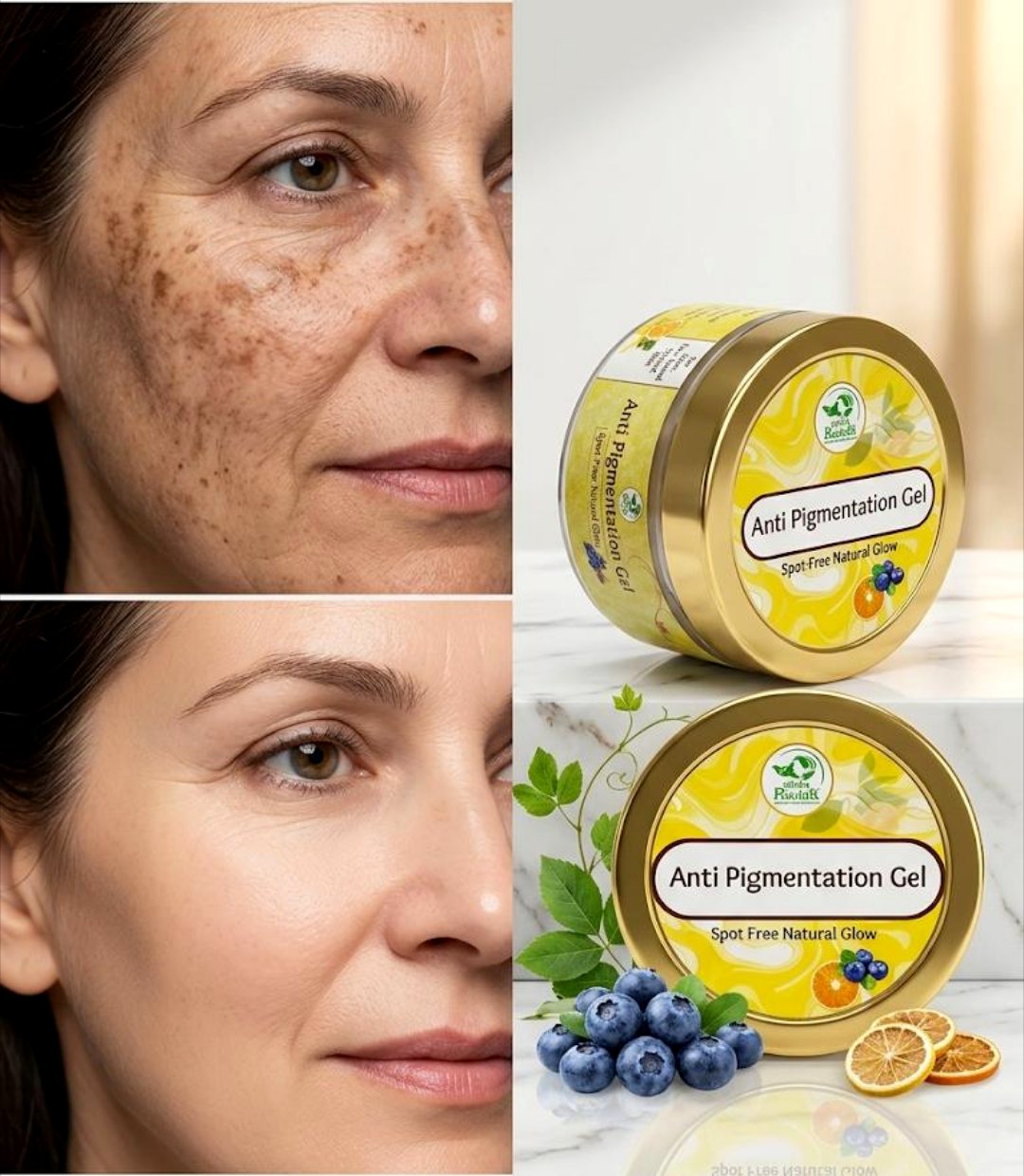 Anti Pigmentation Gel - Image 2
