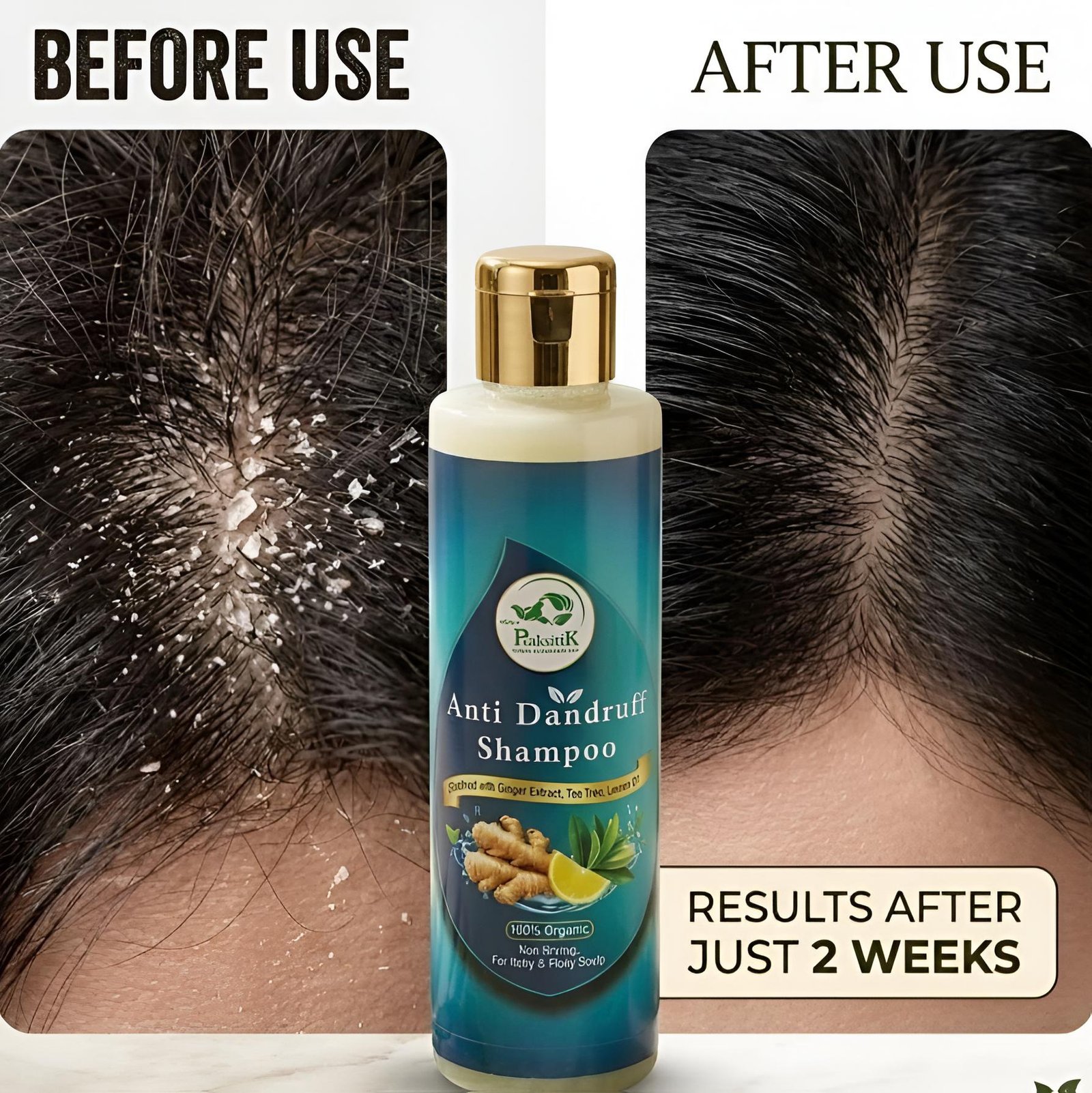 Anti Dandruff Shampoo - Image 2